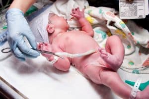 Study Reveals a New Risk for Children with Brachial Plexus Birth Injury